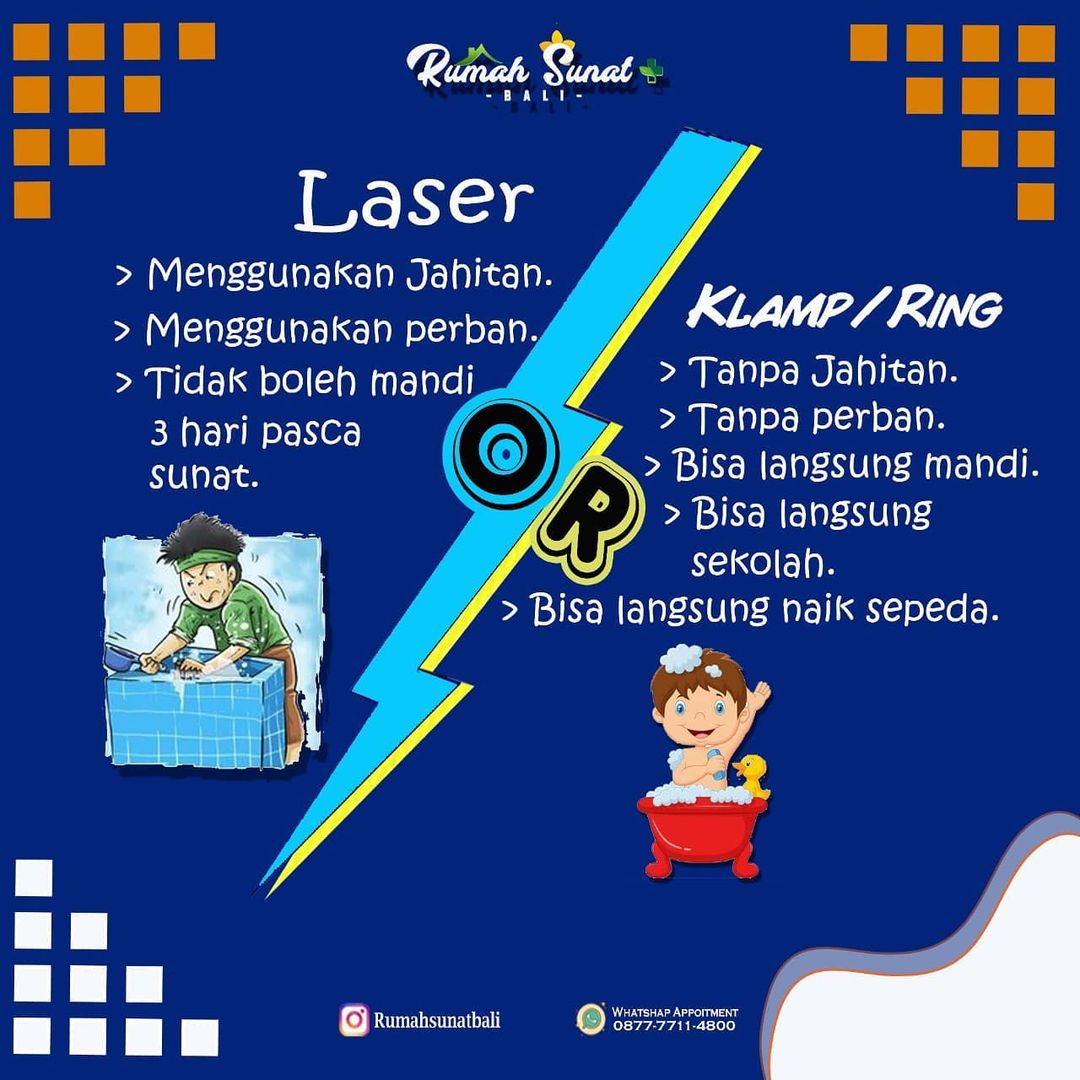 Mengenal Teknik Khitan / Sunat laser