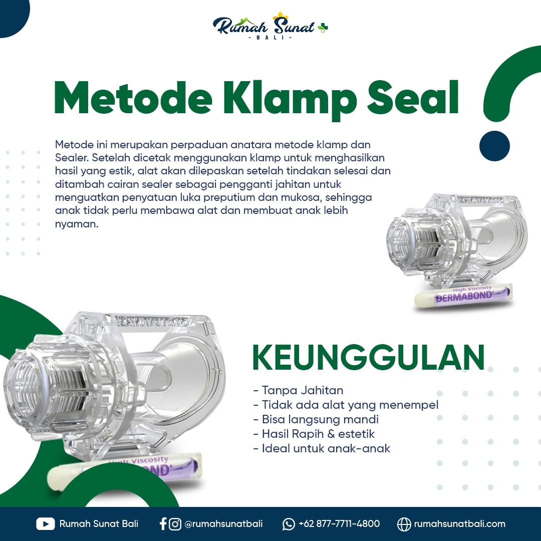 Metode Khitan / Sunat dengan Klamp ( klem )